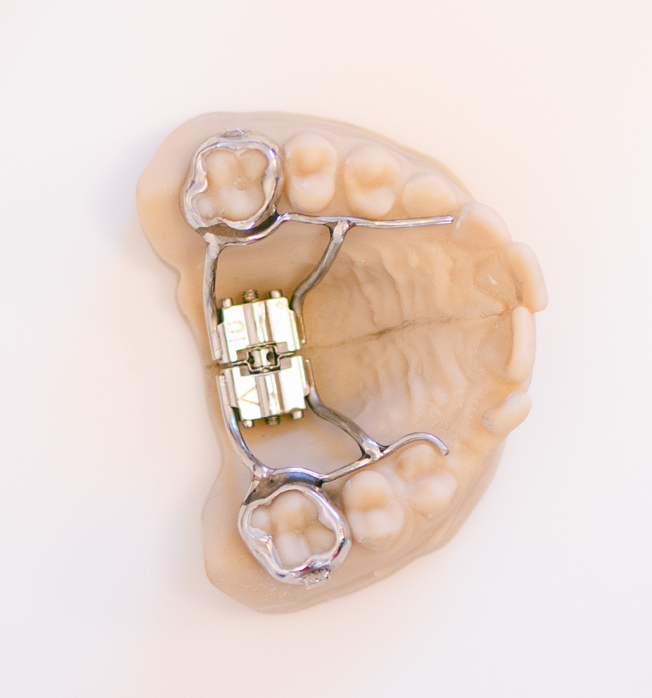 Contention orthodontique